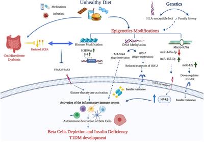 The Interplay Between Diet and the Epigenome in the Pathogenesis of Type-1 Diabetes